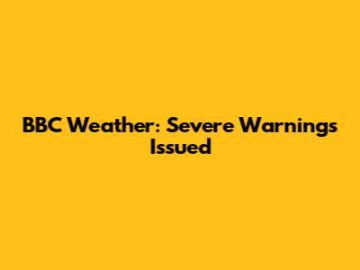 BBC Weather: Severe Warnings Issued