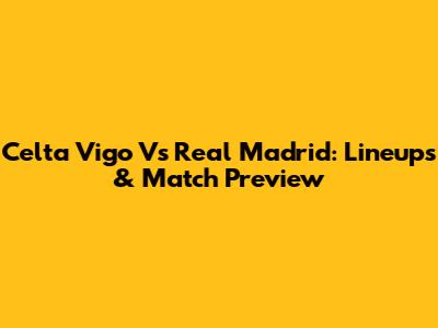 Celta Vigo Vs Real Madrid: Lineups & Match Preview