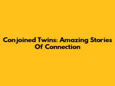 Conjoined Twins: Amazing Stories Of Connection
