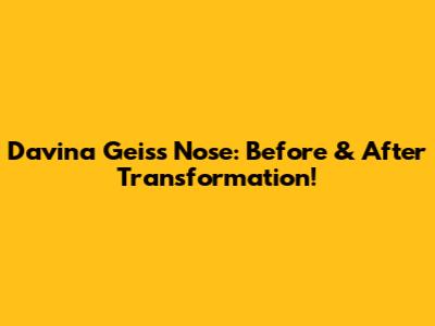 Davina Geiss Nose: Before & After Transformation!