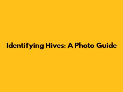 Identifying Hives: A Photo Guide