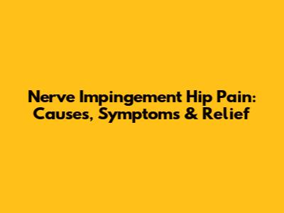 Nerve Impingement Hip Pain: Causes, Symptoms & Relief