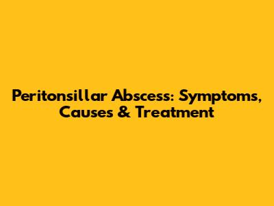 Peritonsillar Abscess: Symptoms, Causes & Treatment