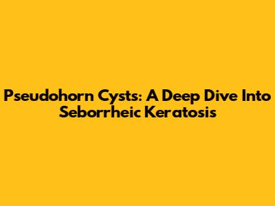 Pseudohorn Cysts: A Deep Dive Into Seborrheic Keratosis