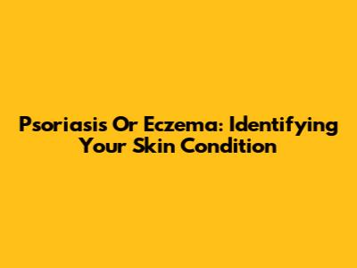 Psoriasis Or Eczema: Identifying Your Skin Condition